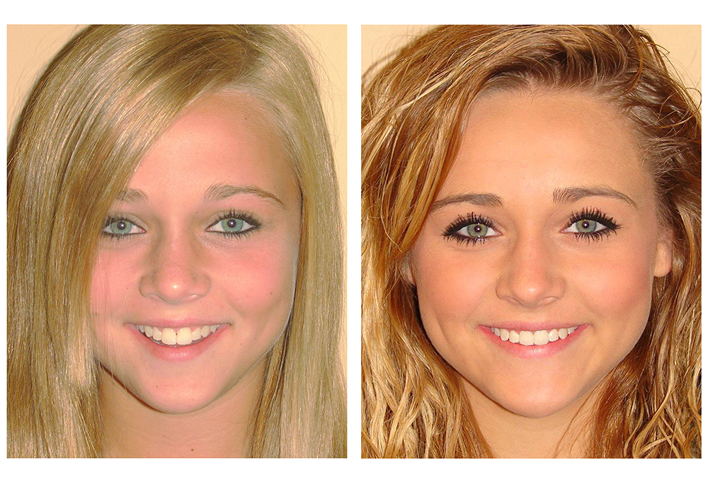 West Islip Orthodontics